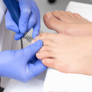 Serviço de podologia em Ramada, Odivelas